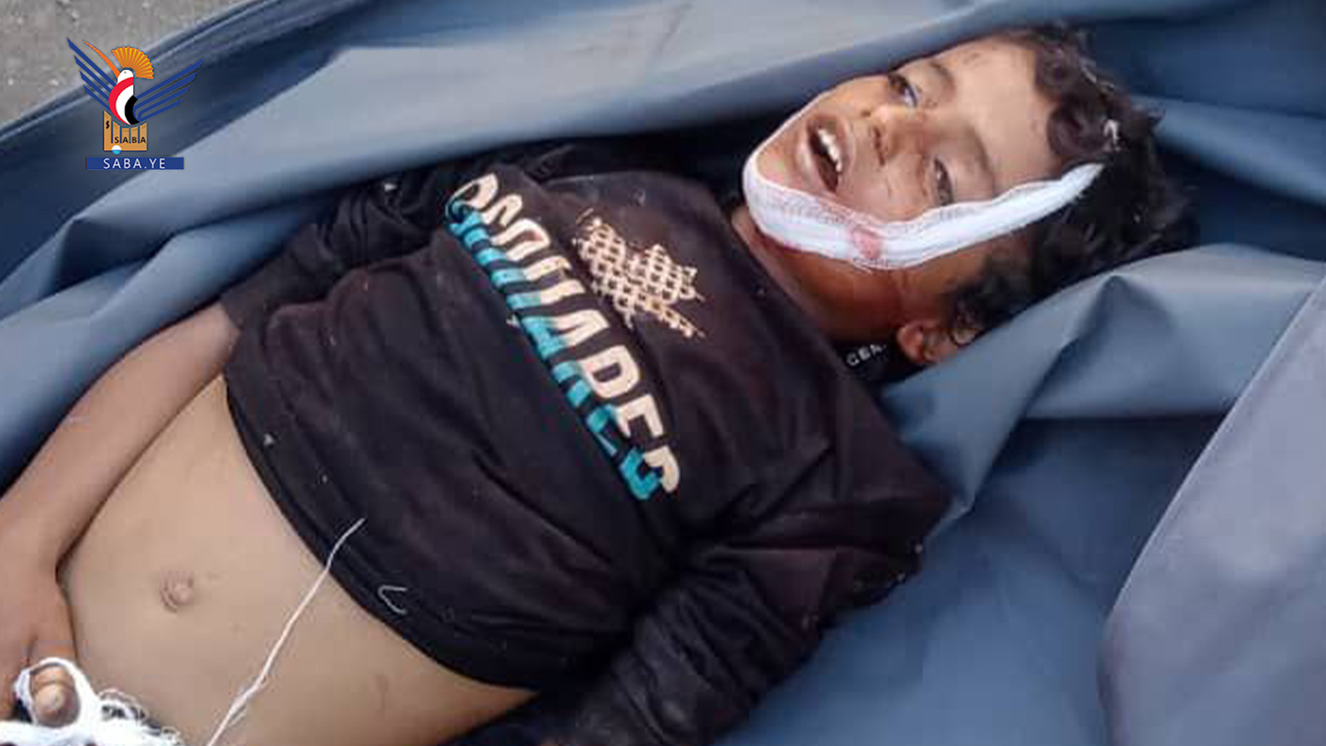 استشهاد طفل بقذيفة أطلقها مرتزقة العدوان على قرية الكامة في مديرية مقبنة بتعز