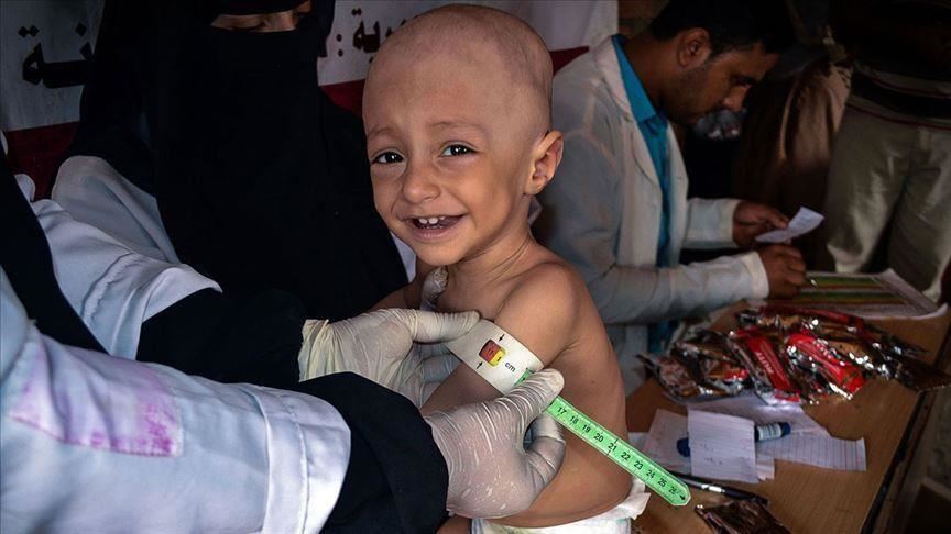 انعدام الدواء بسبب الحصار ​يفاقم معاناة أطفال "الثلاسيميا​"