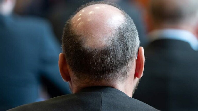 أطعمة تساعد على مكافحة الصلع أطعمة تساعد على مكافحة الصلع