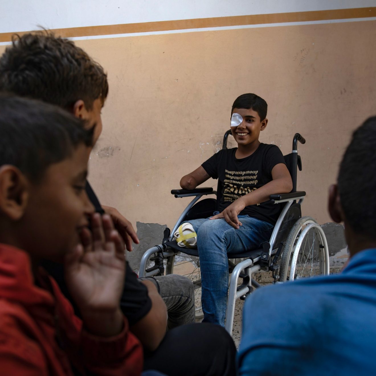البرش: البتر أصبح خيارا وحيدا لأطباء غزة لإنقاذ المصابين البرش: البتر أصبح خيارا وحيدا لأطباء غزة لإنقاذ المصابين