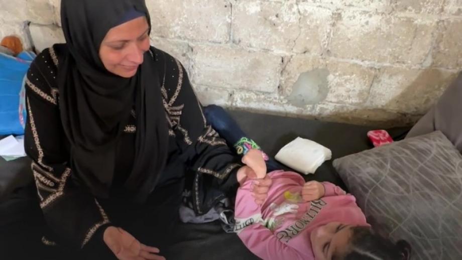 "الحرق الأكبر في قلبي".. أم غزية جريحة تبكي ابنها المبتور وطفلتها المهددة بالموت