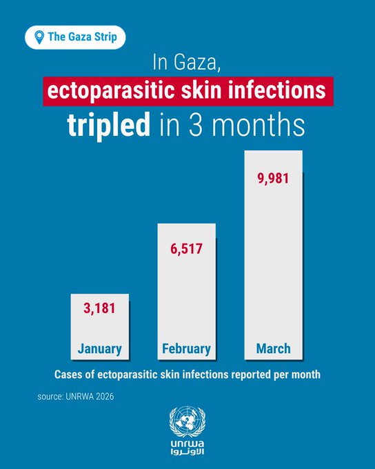 "أونروا": تضاعُف حالات العدوى الجلدية في غزة مع شحّ الادوية واستمرار الحصار