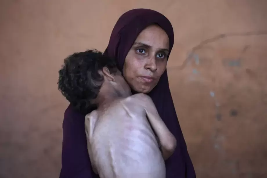 3 حالات وفاة جديدة ترفع وفيات المجاعة وسوء التغذية في غزة إلى 269 شهيدا