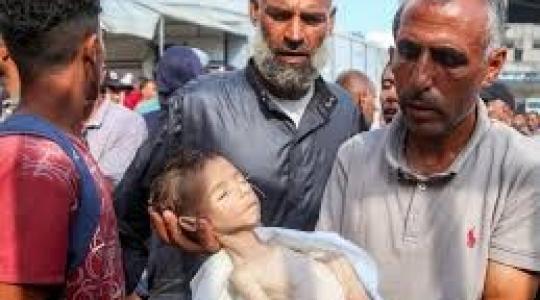"المنظمات الأهلية": 900 ألف طفل يقاسون سوء التغذية في غزة