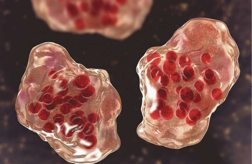 مرض الحصبة يضرب مدينة أمريكية كبرى ويهدد الملايين مرض الحصبة يضرب مدينة أمريكية كبرى ويهدد الملايين