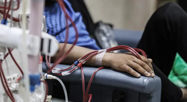 "قسم الكلى بمجمع الشفاء" بغزة: انهيار متسارع للمنظومة الصحية يهدد حياة المرضى