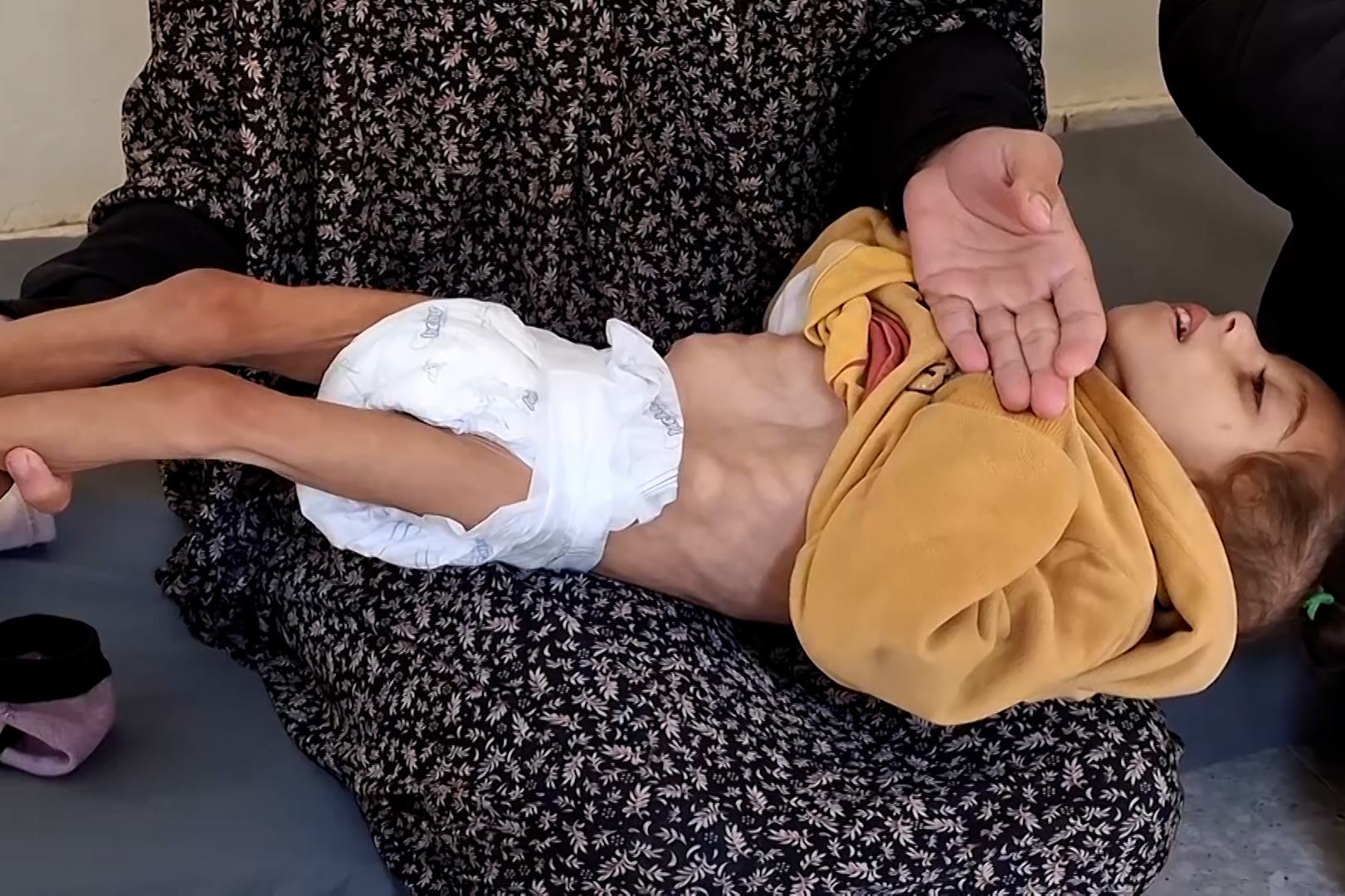 "أونروا”: معظم مواليد غزة يعانون من سوء تغذية حاد والمساعدات لا تكفي