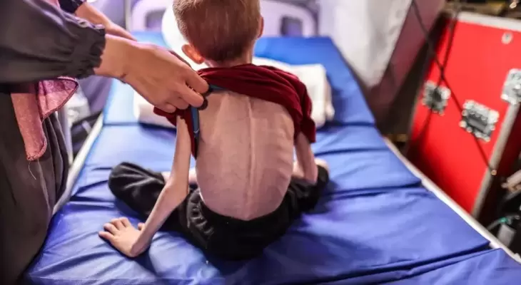 الصحة بغزة:ارتفاع عدد حالات الوفاة نتيجة المجاعة الى 453 حالة  الصحة بغزة:ارتفاع عدد حالات الوفاة نتيجة المجاعة الى 453 حالة