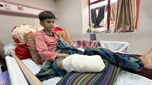 لجنة أممية: 21 ألف طفل في غزة يعانون من إعاقات منذ بدء الحرب