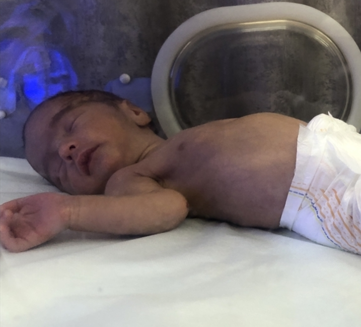 الصحة بغزة: أرواح الأطفال الخدج في خطر 
