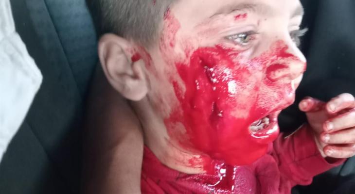 إصابة طفل فلسطيني باعتداء للمستوطنين في الخليل وإجبار عائلات على مغادرة أراضيهم بأريحا