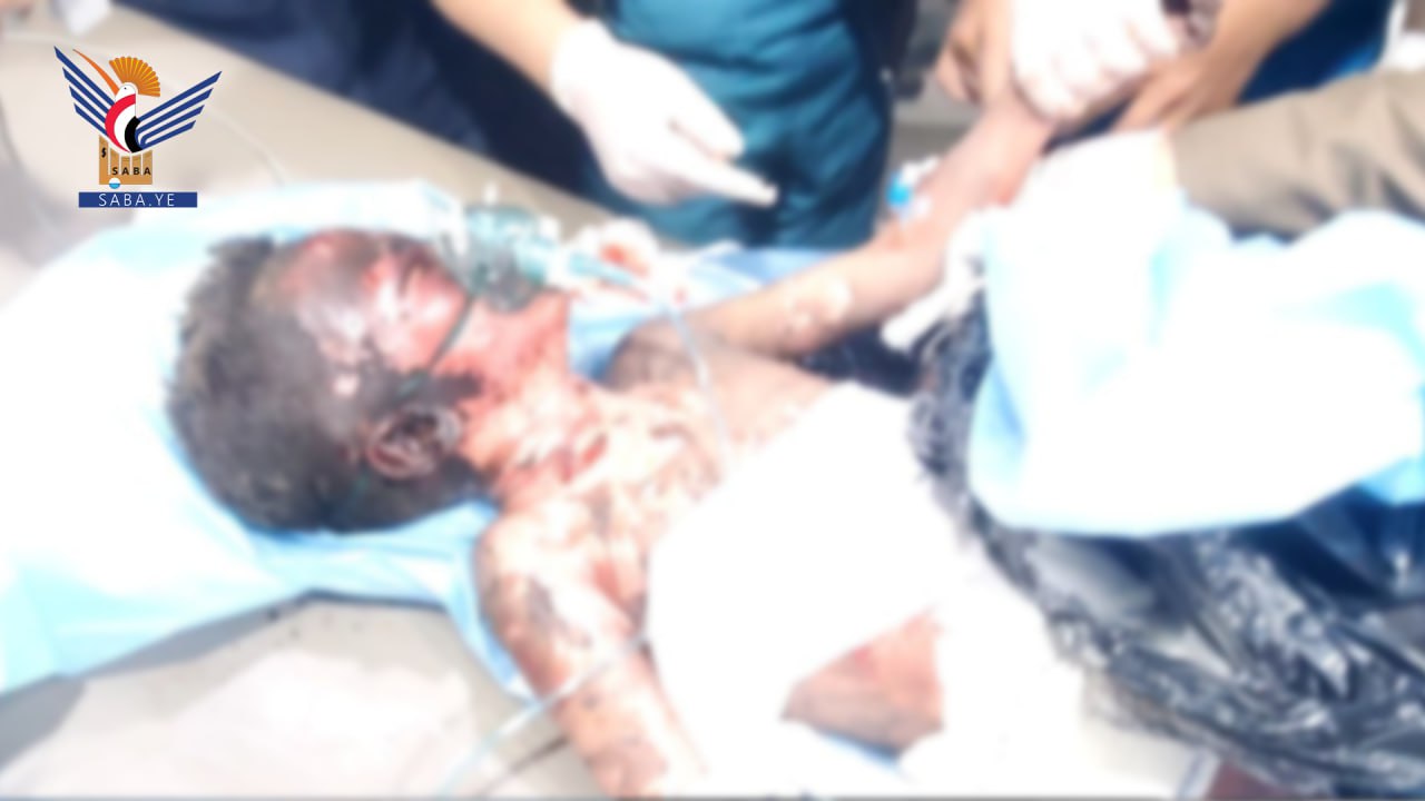 أطفال اليمن .. ضحايا ومعاناة وحرمان في 11 عامًا جراء العدوان الأمريكي السعودي