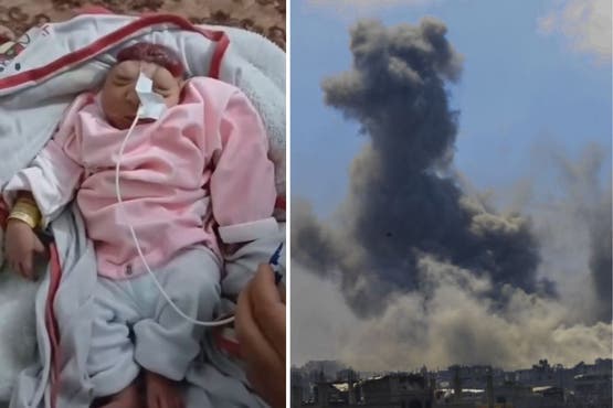 مجمع ناصر بخان يونس: ارتفاع خطير في تشوهات ووفيات المواليد في قطاع غزة