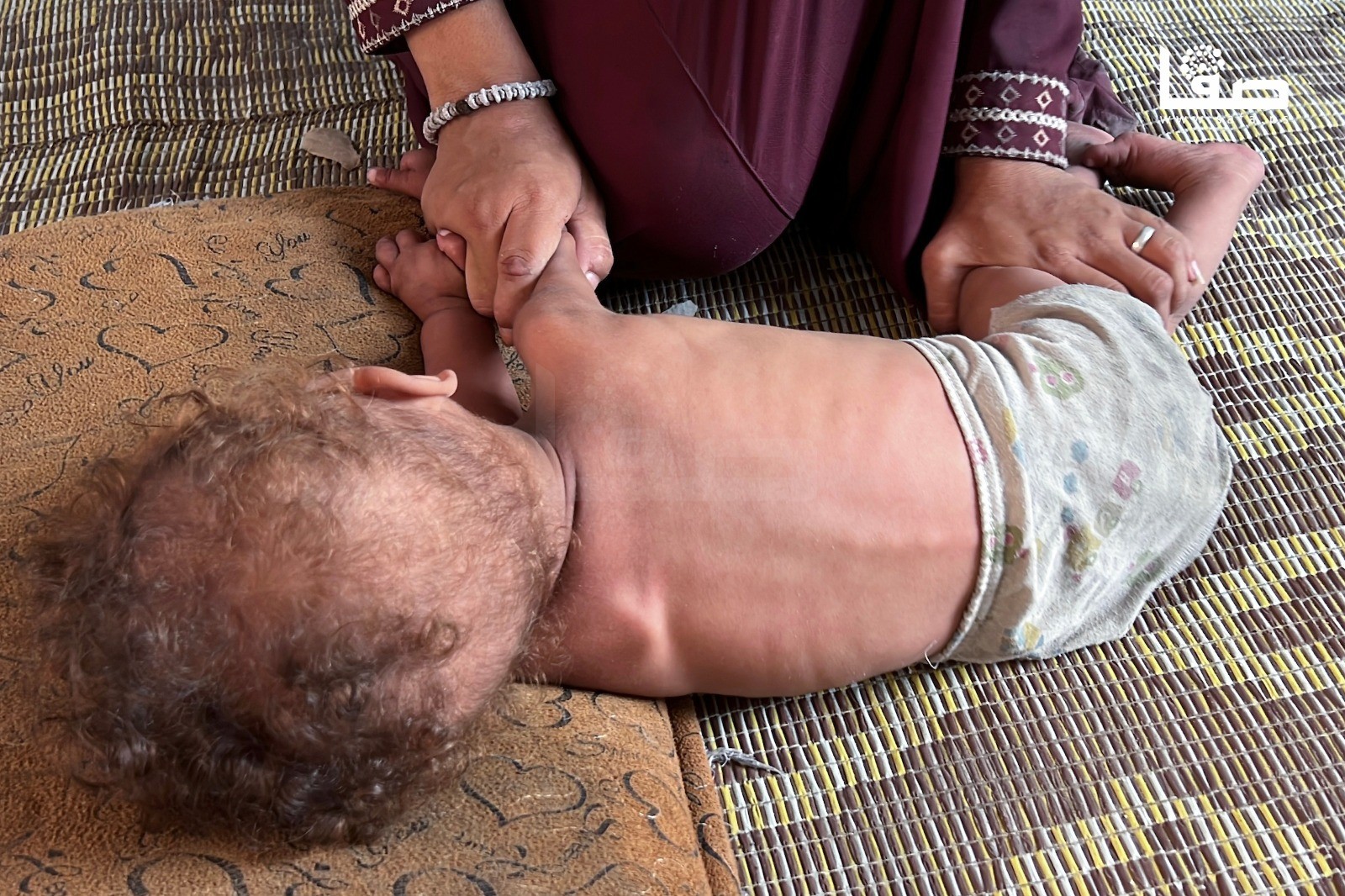 الصحة بغزة: خمس حالات وفاة جديدة بينهم طفلان نتيجة سوء التغذية في غزة
