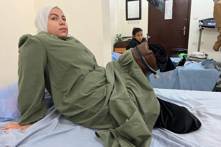 وزارة الصحة بغزة: النساء يشكلن 8% من حالات البتر والأمهات الأكثر معاناة