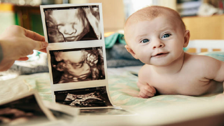 “معجزة إلهية”.. طفل بأربع أرجل يثير حيرة الأطباء! “معجزة إلهية”.. طفل بأربع أرجل يثير حيرة الأطباء!