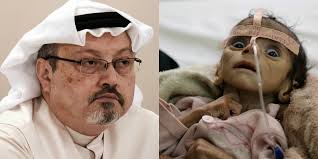 ما وراء قضية خاشقجي والحرب في اليمن ما وراء قضية خاشقجي والحرب في اليمن
