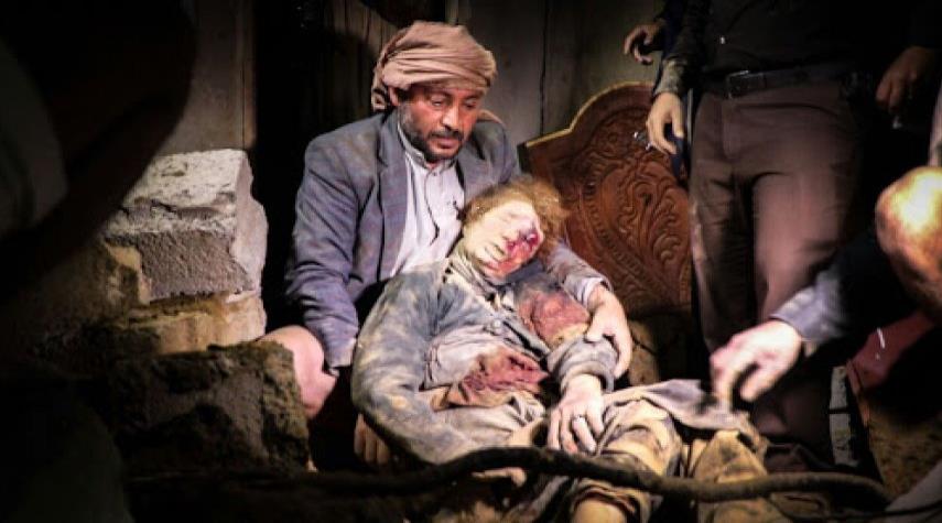 النفاق العالمي والإعلامي في حرب اليمن..! النفاق العالمي والإعلامي في حرب اليمن..!