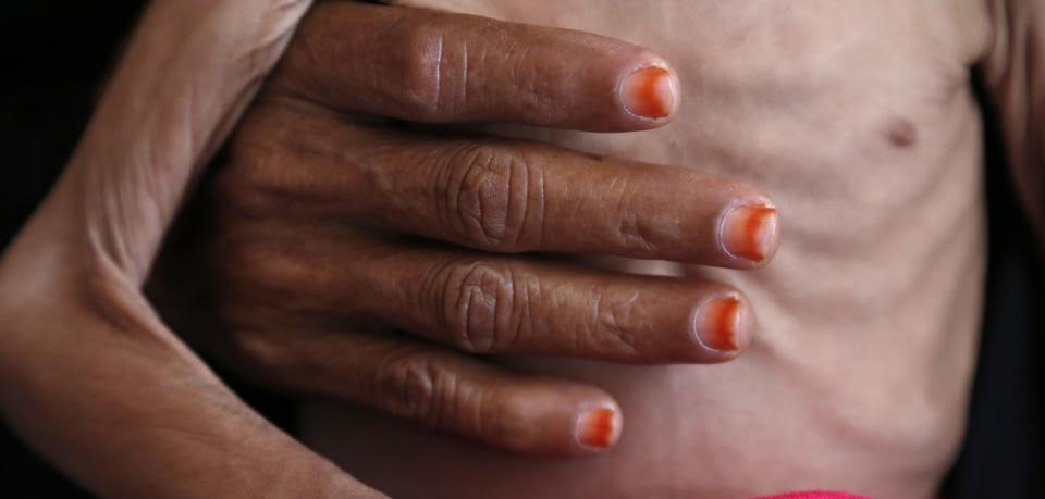 حدود أطباء بلا حدود حدود أطباء بلا حدود