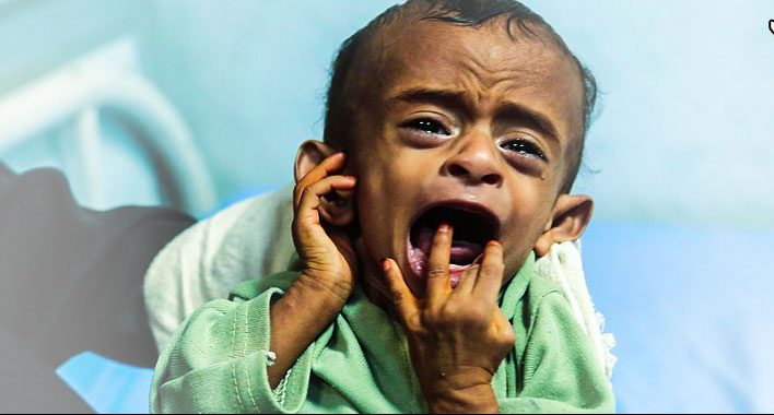 العقوبات الأمريكية عقبة كبيرة أمام تقديم المساعدات لليمن