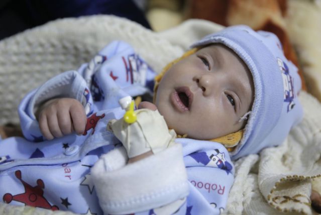 ألمانيا تكيل بمكيالين في اليمن ألمانيا تكيل بمكيالين في اليمن