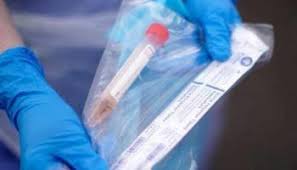 أمريكا تصارع كورونا بـ100 مليون جرعة لقاح تجريبي أمريكا تصارع كورونا بـ100 مليون جرعة لقاح تجريبي