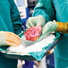 ماذا يحدث لجسم المتبرع بالأعضاء؟ ماذا يحدث لجسم المتبرع بالأعضاء؟