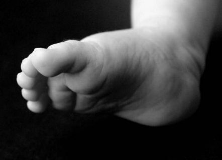 كيف نمنع تورم القدمين صيفا؟ كيف نمنع تورم القدمين صيفا؟