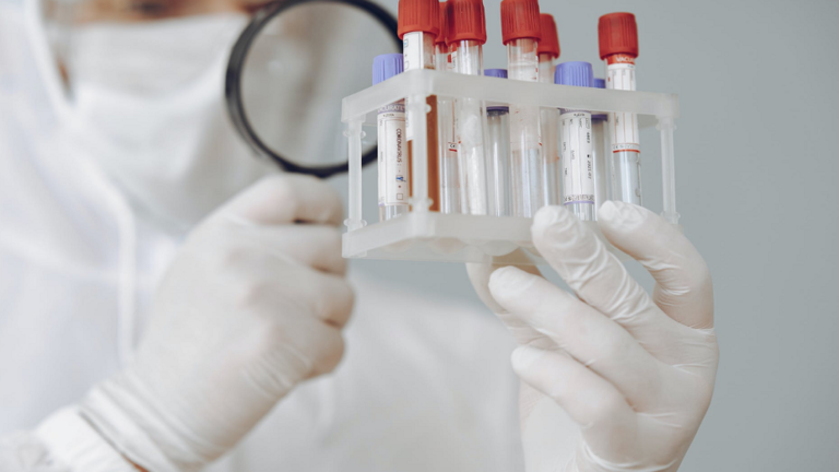 العلماء ينبهون لعلامة تحذير رئيسية رابعة لـ”كوفيد-19″ العلماء ينبهون لعلامة تحذير رئيسية رابعة لـ”كوفيد-19″