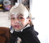 غزة: محمد حجيلة… طفولة مسروقة من الحرب وأمل ضائع بين الحروق والصمت