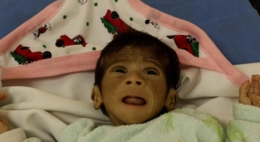 "يونيسف" تحذر من تفشي الأمراض بين أطفال غزة وتدعو لتكثيف المساعدات الإنسانية