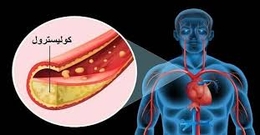 إعراض تشير لارتفاع الكوليسترول بشكل مخيف