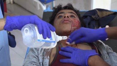 استشهاد طفلة في قصف مدفعي لمرتزقة العدو السعودي على مديرية صبر الموادم