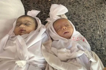 الصحة بغزة: 1500 طفل ينتظرون السفر للعلاج و110 آلاف يعانون سوء التغذية