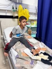 العدو الصهيوني يصيب طفلا فلسطينيا في قلقيلية