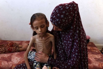 أطفال غزة.. أجساد نحيلة وعيون غائرة وحياة ينهشها التجويع الصهيوني