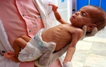  الإعلامي الحكومي : 100,000 طفل في غزة يوجهون خطر الموت الجماعي