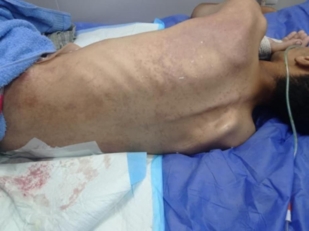 ثمانية أشهر من الوجع.. "نبيل أبو جبر" الغزّاوي بين الألم والانتظار القاسي