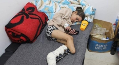 مصادر طبية بغزة:جريمة الإبادة تضاعف حالات البتر في الأطراف لأكثر من 225%