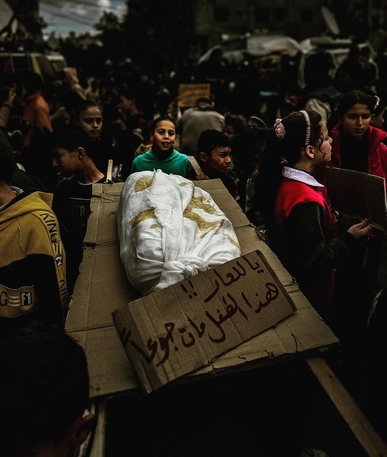 الصحة بغزة: ارتفاع حصيلة شهداء الجفاف وسوء التغذية إلى 20