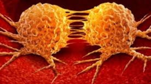 فريق من الباحثين في بريطانيا يتوصل إلى تقنية جديدة لتشخيص أورام الدماغ فريق من الباحثين في بريطانيا يتوصل إلى تقنية جديدة لتشخيص أورام الدماغ