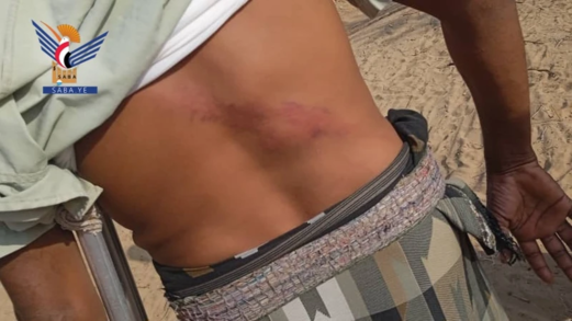 مرتزقة العدوان يعتدون على صيادين بسواحل ميدي في حجة