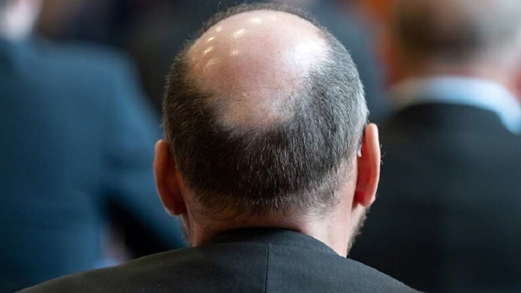 أطعمة تساعد على مكافحة الصلع أطعمة تساعد على مكافحة الصلع