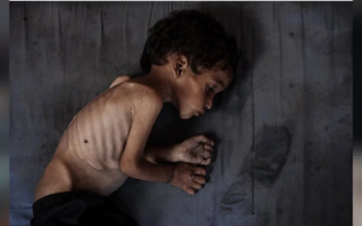  ارتفاع وفيات الأطفال نتيجة البرد الشديد إلى 7 حالات