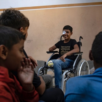 البرش: البتر أصبح خيارا وحيدا لأطباء غزة لإنقاذ المصابين البرش: البتر أصبح خيارا وحيدا لأطباء غزة لإنقاذ المصابين