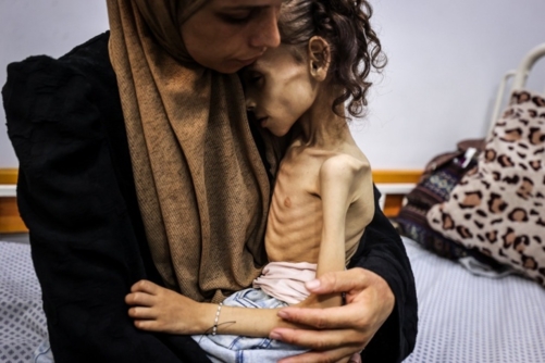 "الصحة بغزة”: 5 وفيات بينهم طفلان نتيجة المجاعة وسوء التغذية خلال الـ24 ساعة الماضية