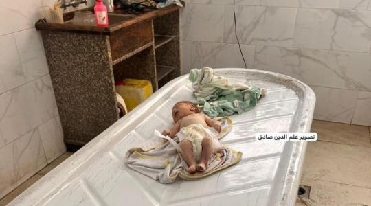 غزة: استشهاد رضيع فلسطيني ثان بسبب سوء التغذية خلال 24ساعة