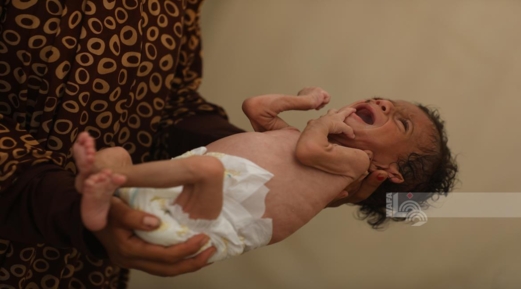 الصحة بغزة :تسجيل سبع وفيات نتيجة المجاعة خلال الـ24 ساعة الماضية  الصحة بغزة :تسجيل سبع وفيات نتيجة المجاعة خلال الـ24 ساعة الماضية