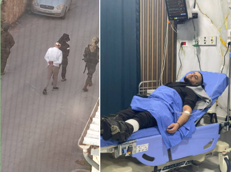 العدو الإسرائيلي يعتدي على 4 فلسطينيين في جبع جنوب جنين ويتسبب في احتراق منزل بعابود شمال رام الله