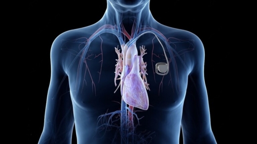 باحثة روسية تُطور مصدر طاقة "أبدي" لجهاز تنظيم ضربات القلب باحثة روسية تُطور مصدر طاقة "أبدي" لجهاز تنظيم ضربات القلب